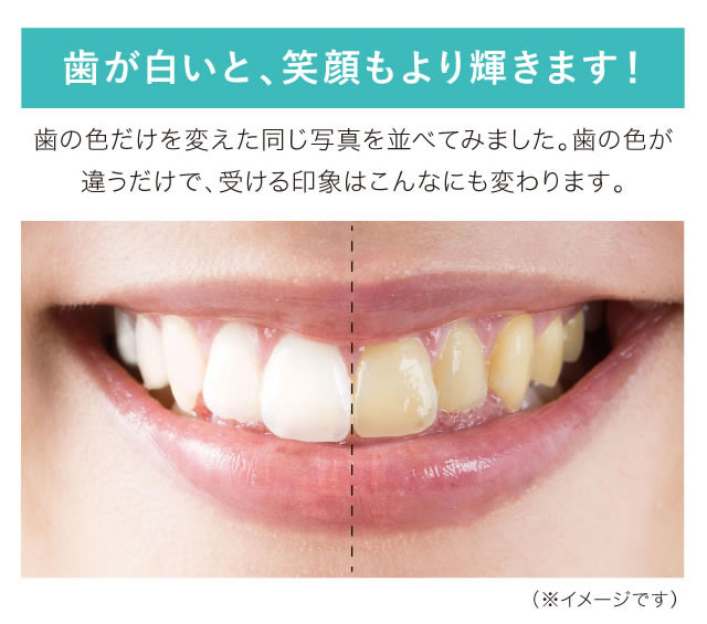歯が白いと笑顔もより輝く。歯の色が違うだけで印象は変わる