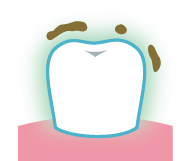 歯の汚れ