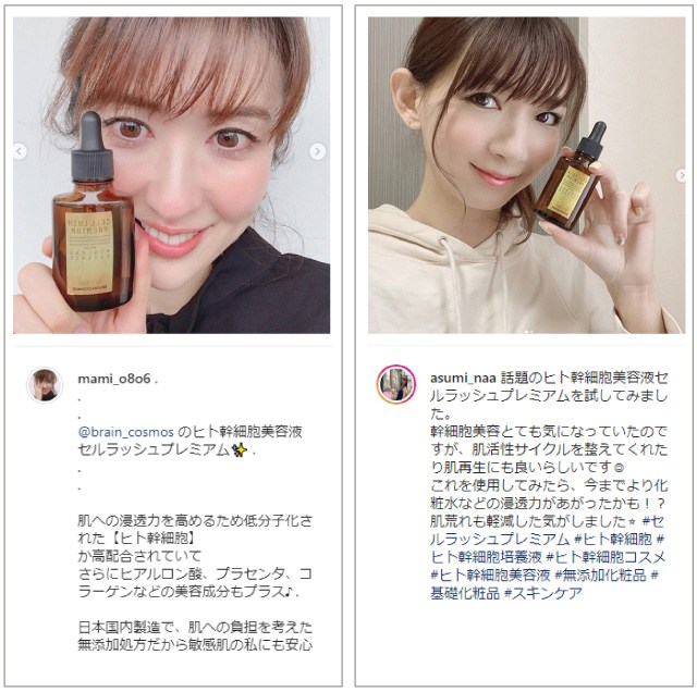 ヒト幹細胞コスメ口コミ